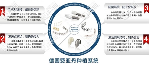 德國費(fèi)亞丹ankyos Xive種植體 德國費(fèi)亞丹ankyos Xive種植體