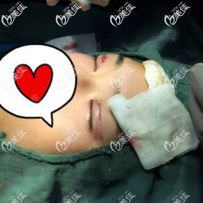 眼綜合手術(shù)過(guò)程圖片 眼綜合手術(shù)過(guò)程圖片