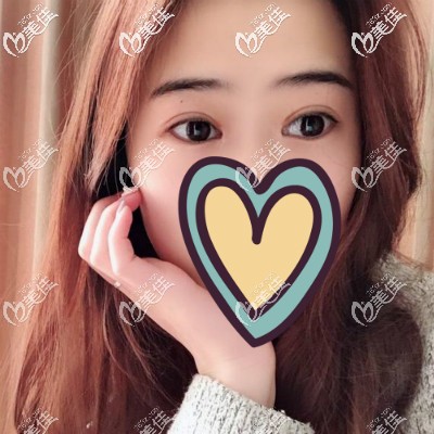 做完眼綜合都丑了?我眼綜合術(shù)后10天照片很丑,3個(gè)月恢復(fù)的特別自然好看