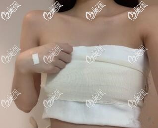 術(shù)后4天 術(shù)后4天