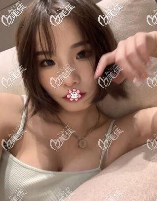 在泰國然禧做完胸20天了 在泰國然禧做完胸20天了