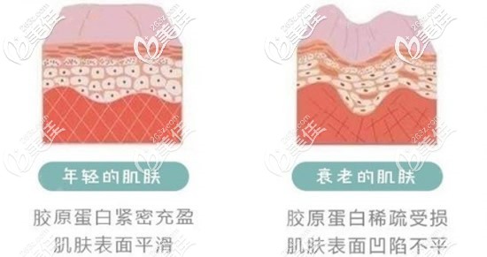 年輕肌膚和衰老肌膚對(duì)比 年輕肌膚和衰老肌膚對(duì)比