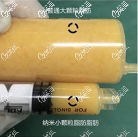 普通脂肪和脂肪膠的區(qū)別 普通脂肪和脂肪膠的區(qū)別