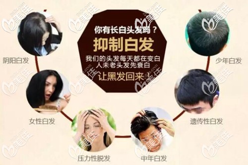 德生源何首烏洗發(fā)水治白發(fā)原理 德生源何首烏洗發(fā)水治白發(fā)原理