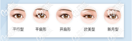 各種雙眼皮類型 各種雙眼皮類型