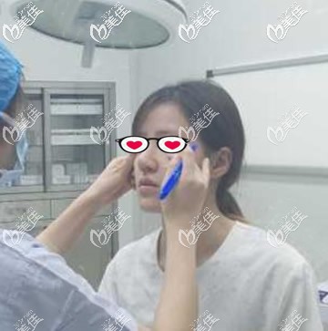 蘭州夢(mèng)想整形趙梅霞設(shè)計(jì)面部提升方案