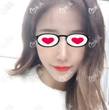 千萬不要玻尿酸填充法令紋!面部松弛下垂的人注射后法令紋可能會鼓起來一條肉!