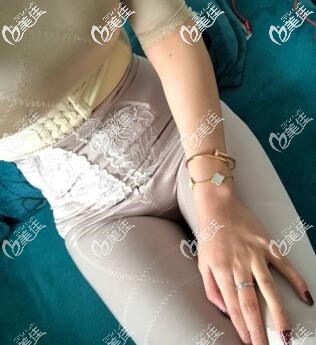 我在貴陽華美做完吸脂手術(shù)半個月了 我在貴陽華美做完吸脂手術(shù)半個月了