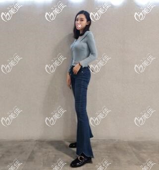 貴陽吸脂不貴還真能瘦，在貴陽華美做完腰腹+大腿抽脂3個月后我都穿xs碼的褲子了