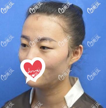 蘭州時光相伴整形醫(yī)院趙梅霞<span style= 蘭州時光相伴整形醫(yī)院趙梅霞<span style=