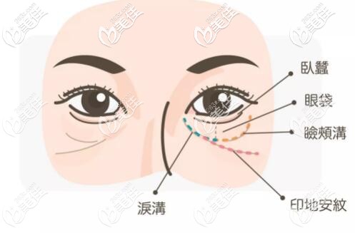 印第安紋的位置 印第安紋的位置