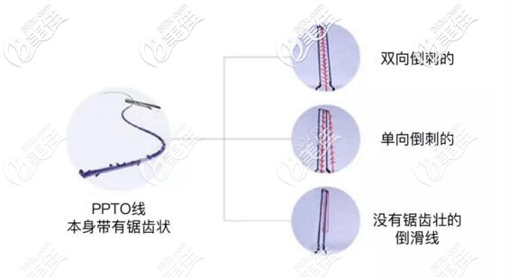 蛋白線的不同種類 蛋白線的不同種類