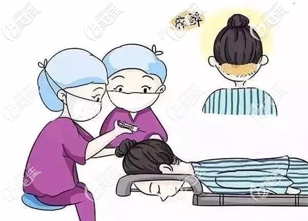 植發(fā)手術(shù)局部麻木