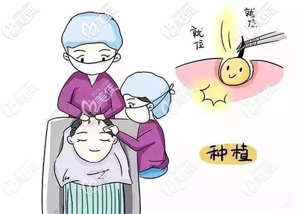 毛囊種植需要考慮密度、方向、種植深度等問題