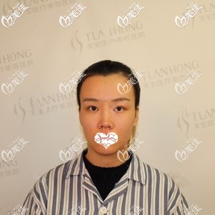 術(shù)前鼻子扁塌 術(shù)前鼻子扁塌