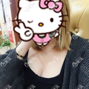 假體隆胸術(shù)后24天腫脹漸消