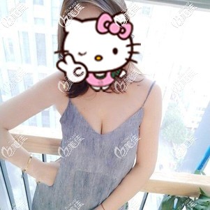 害怕隆胸后假體像球一樣滑動，不如和我一樣找做成脂肪+假體的復合式豐胸