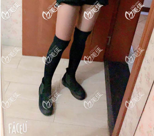 留學(xué)妹告訴你泰國(guó)哪家醫(yī)院做吸脂好，請(qǐng)欣賞我在泰國(guó)塔娜做的大腿吸脂