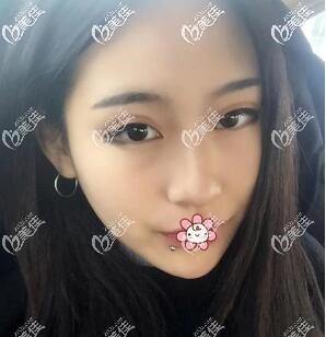 兩個(gè)月以后 兩個(gè)月以后