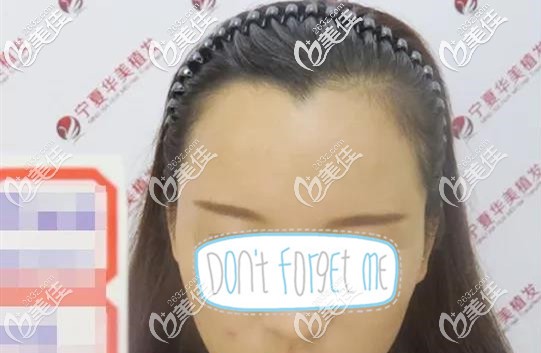 我天生發(fā)際線高額頭大 我天生發(fā)際線高額頭大