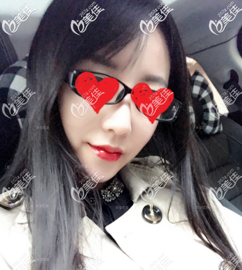 西安藝星玻尿酸豐唇第二天照片 西安藝星玻尿酸豐唇第二天照片