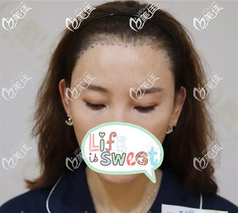 根據(jù)臉型設(shè)計(jì)的發(fā)際線 根據(jù)臉型設(shè)計(jì)的發(fā)際線