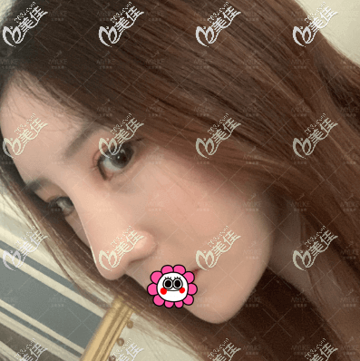 做第四代熱瑪吉有一個月了 做第四代熱瑪吉有一個月了