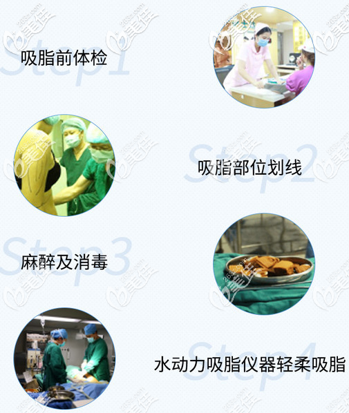 廣東美恩顧榮吸脂手術(shù)過程圖 廣東美恩顧榮吸脂手術(shù)過程圖
