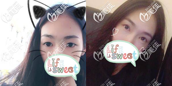 之前的眼睛雖然大，但是不夠有魅力