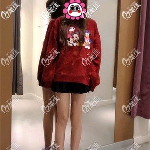 做大腿吸脂恢復(fù)20天效果怎么樣？