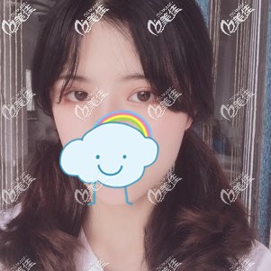 做眼綜合6800貴嗎？我到合肥整形機(jī)構(gòu)去做去眼袋+去脂+切開雙眼皮都花了7千多