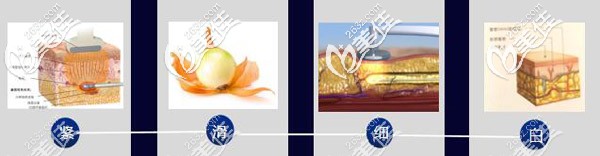 BodyTite+脂肪3D光雕科技技術(shù)原理 BodyTite+脂肪3D光雕科技技術(shù)原理