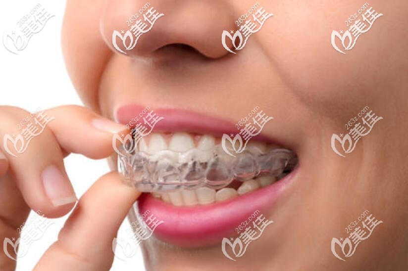 隱形牙套