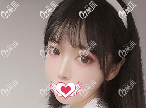 做雙眼皮開(kāi)眼角真心會(huì)變丑？我花2萬(wàn)元做8mm的眼綜合怎么感覺(jué)輕輕松松就變美了！