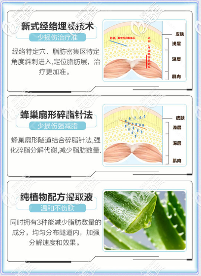 重慶華美S魔力瘦三大特色