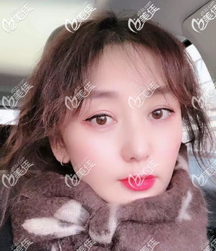 你相信“千萬不要做臉部埋線提升或臉部埋線以后老的快