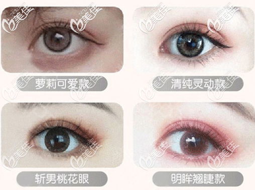 東莞天后<!--<i data=20240703-sp></i>-->雙眼皮類型 東莞天后<!--<i data=20240703-sp></i>-->雙眼皮類型