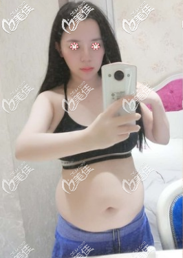 術(shù)前的我 術(shù)前的我