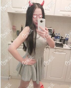 新疆黎美腰腹水動力吸脂3個月 新疆黎美腰腹水動力吸脂3個月