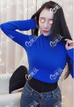 剛做完水動力腰腹吸脂后我肚皮很硬鼓鼓的，三個月后腰細了20cm