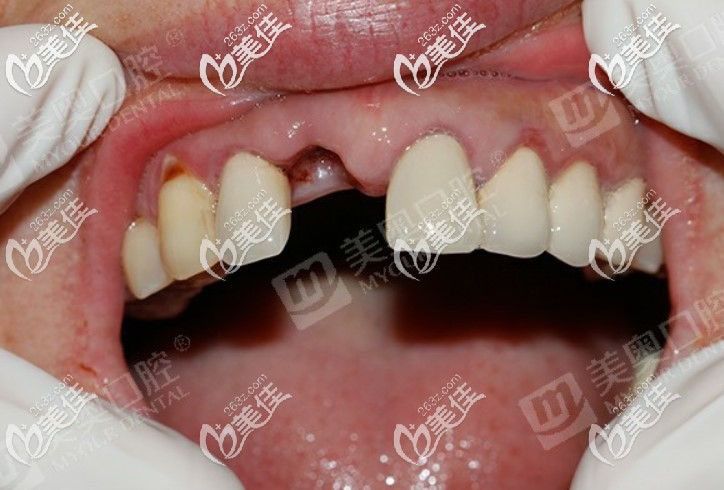 趁活動在蘇州美奧<span style=