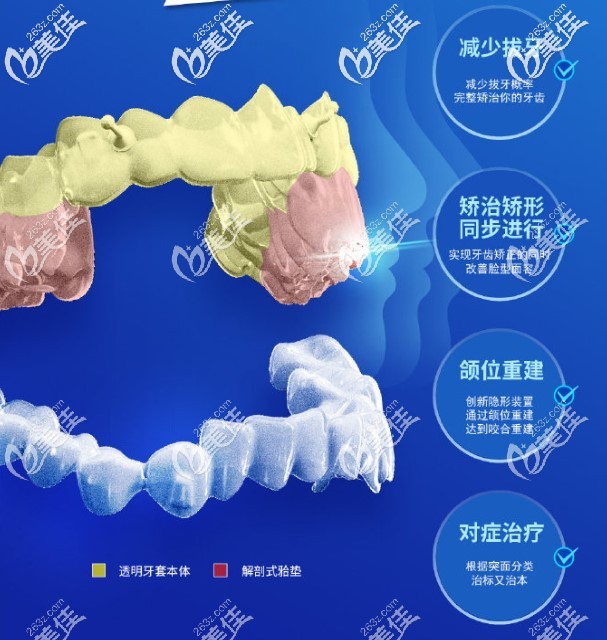 正雅隱形矯正有這些好處