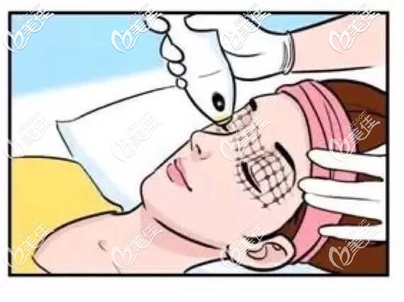 熱瑪吉抗衰的原理 熱瑪吉抗衰的原理