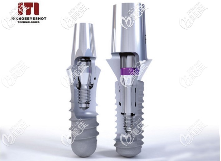 蘇州瑞士iti種植體收費(fèi)