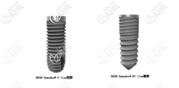 在蘇州種一顆德國貝格植體的價(jià)格