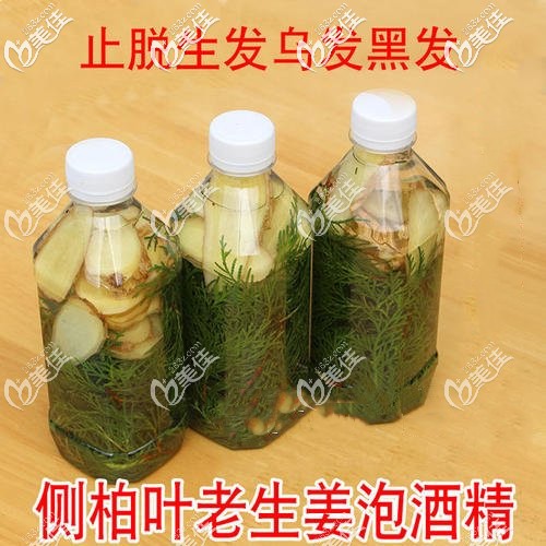 側(cè)柏葉生姜泡酒治脫 側(cè)柏葉生姜泡酒治脫