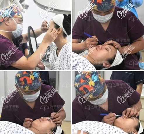 包頭葉子肋軟骨隆鼻前設(shè)計(jì)手術(shù)方案 包頭葉子肋軟骨隆鼻前設(shè)計(jì)手術(shù)方案