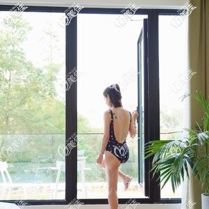 給大家看下我在泰國做腰腹環(huán)吸后10天到恢復(fù)半年的照片 沒有出現(xiàn)反彈和皮膚松弛問題