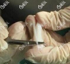 防止全肋骨鼻歪或變形的方法介紹 防止全肋骨鼻歪或變形的方法介紹