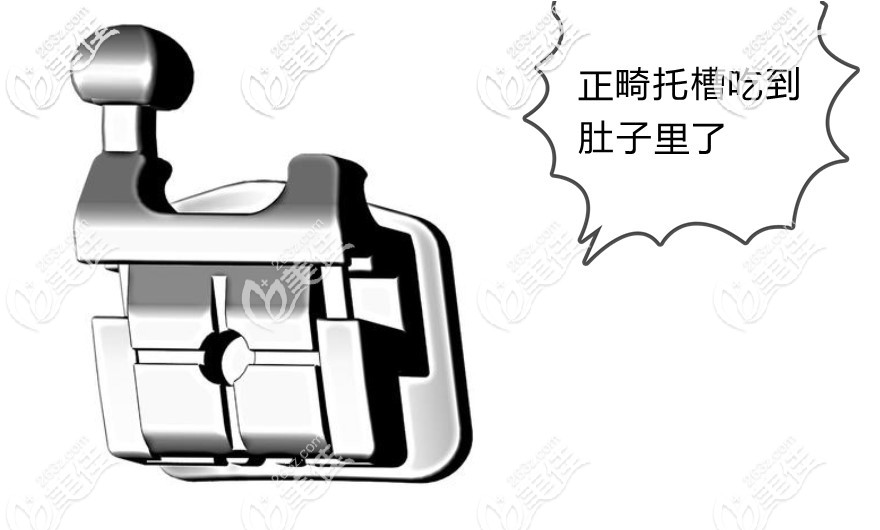 正畸托槽沒粘緊吃肚子里了怎么辦